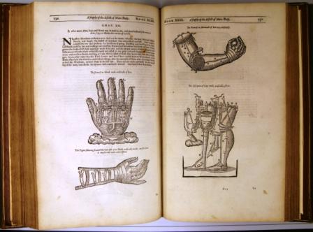 SxUniversityRareBooks/784 - The works of that famous chirurgeon Ambrose Parey, 1678