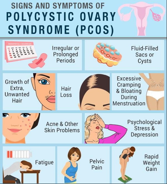 Diagram illustrating signs and symptoms of Polycystic Ovary Syndrome (PCOS) with labelled sections and corresponding illustrations. Key symptoms include irregular periods, fluid-filled cysts, unwanted hair growth, hair loss, menstrual cramping, acne, psychological stress, fatigue, pelvic pain, and rapid weight gain, each depicted with simple visual icons and text.
